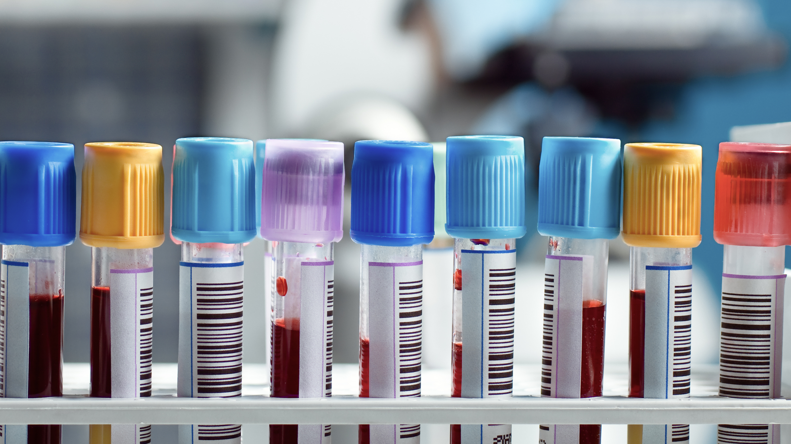 Exames essenciais para quem tem diabetes