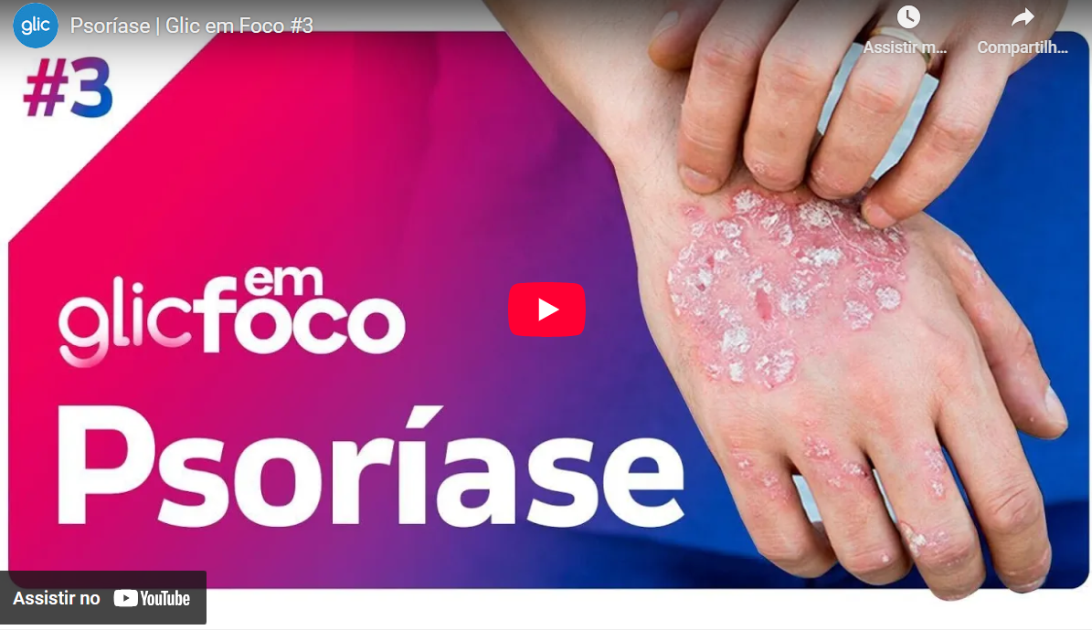 Psoríase | Glic em Foco #3